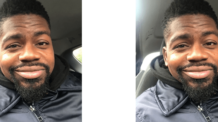 Season 7 Ep. 3: T1D, Kidney Transplant, Black Lives Matter, and More from Across the&nbsp;Pond